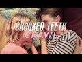 Crooked Teeth - Crawl feat. Bonnie from Stand Atlantic (Official Music Video)