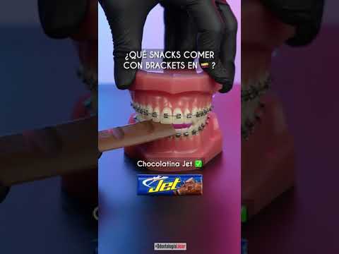 ¿Que comer con brackets en 🇨🇴 ? - Odontología Láser #Shorts