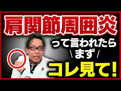 癒着性肩関節包炎 - 定義