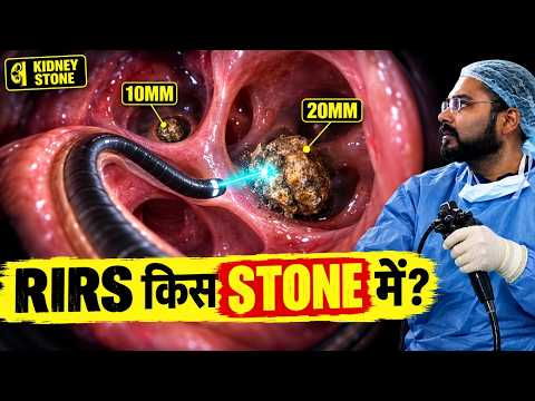 RIRS Kidney Stone Surgery | Flexible Laser Treatment | बिना चीरे पथरी