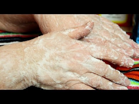 Хочу как ты веснушки Рецепт от пигментных пятен с лимоном