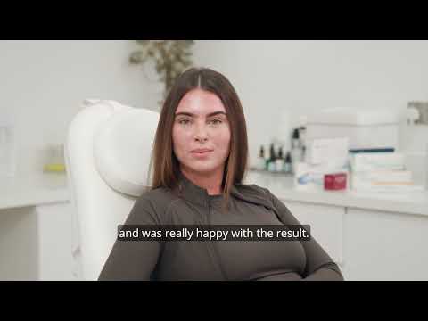 Patient testimonial for injectables & skincare for breakouts at Dr Ana • The Skin Clinic