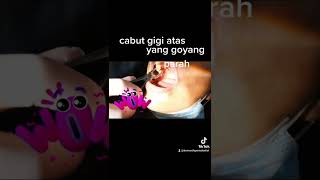 Download lagu Cabut Gigi Atas mp3