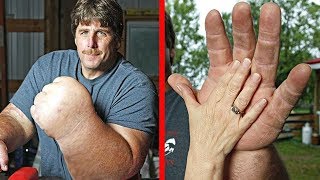5 ЛЮДЕЙ, ПОЛУЧИВШИХ СУПЕРСПОСОБНОСТИ