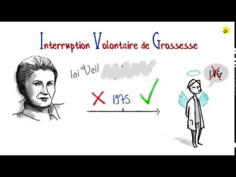 download lagu mp3 mp4 Ivg France, download lagu Ivg France gratis, unduh video klip Ivg France
