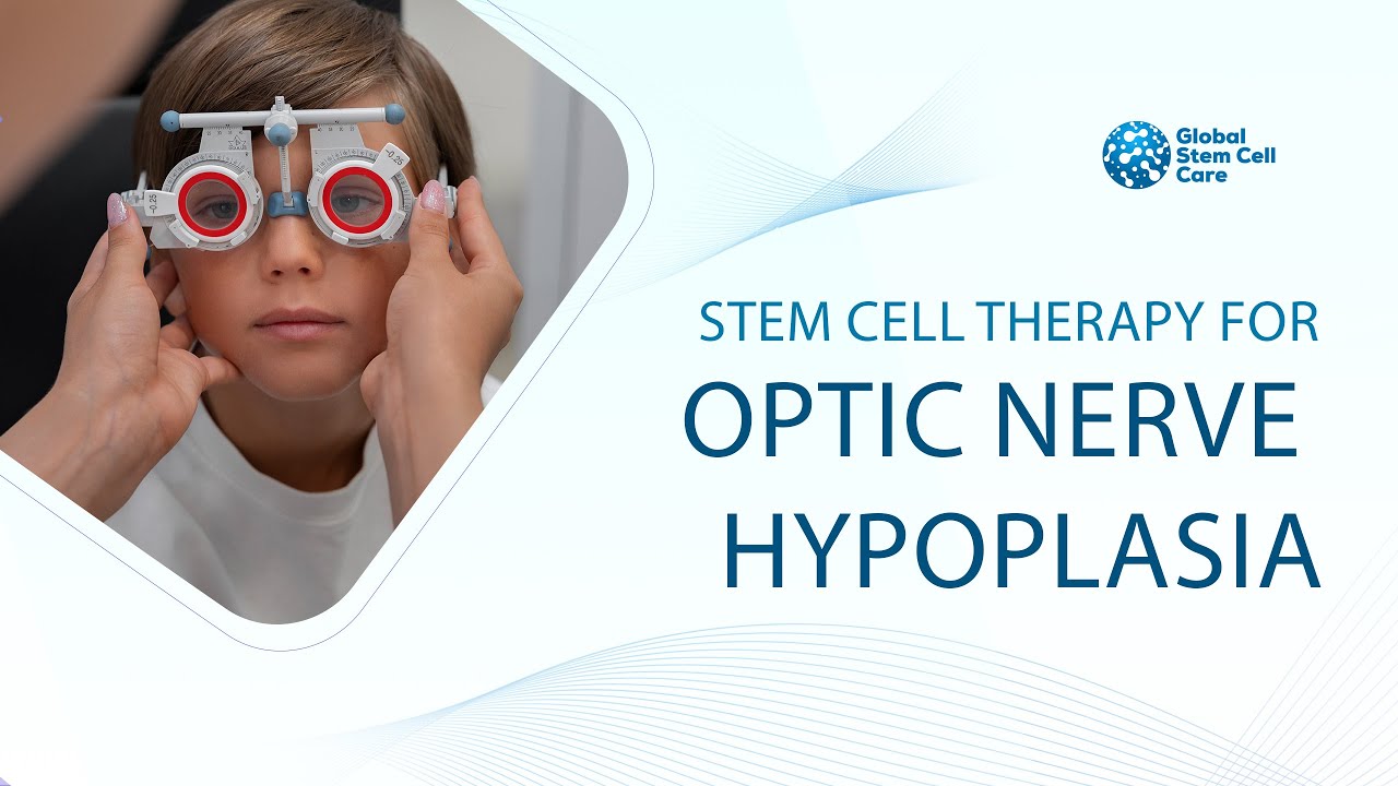  Stem Cell Treatment For Optic Nerve Hypoplasia | Best Treatment For Optic Nerve Hypoplasia
