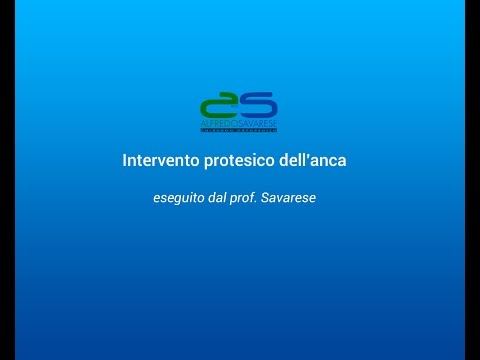 Clinica specializzata in sostituzione delle articolazioni Esercizi fisici con osteocondrosi