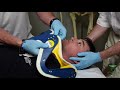 Fitting a Cervical Collar