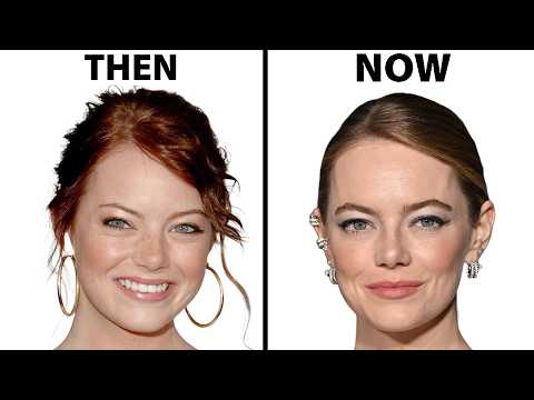 Emma Stone's NEW FACE | Plastic Surgery Analysis