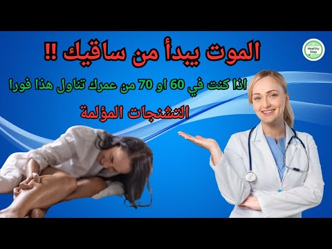 أفضل 3 أطعمة للوقاية من التشنجات العضلية في الساقين لدى كبار السن