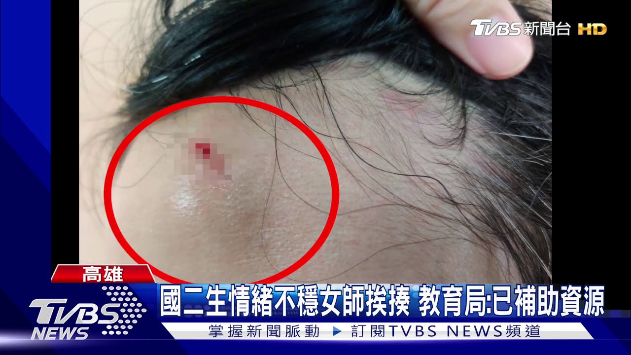 「下課再問」國二生暴走怒砸 女師瘀青、腦震盪