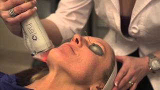 The Halo Hybrid Fractional Laser in Action