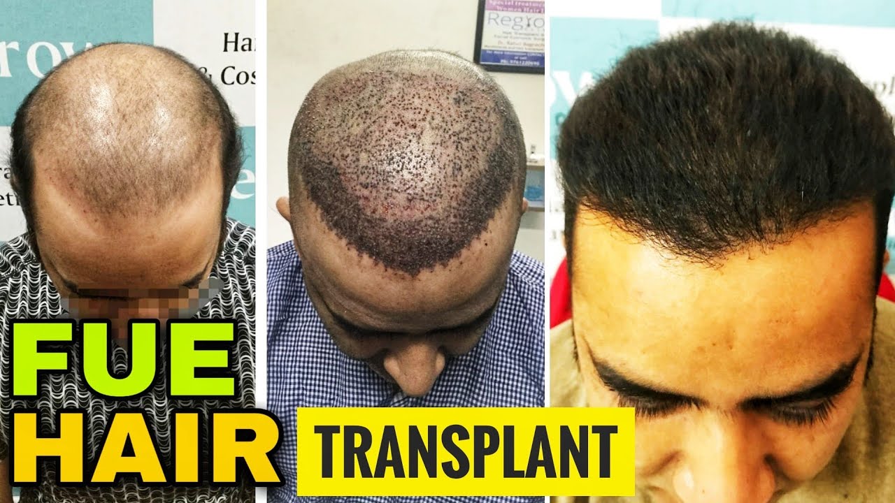 https://www.youtube.com/embed/tzzXJLG7vRQ