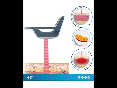 Wissenswertes über den Hochleistungsaser von BTL
