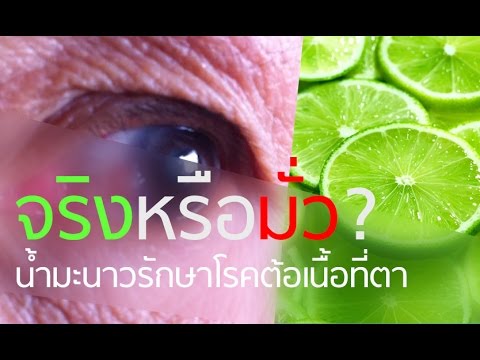 Basma โรคสะเก็ดเงิน วิธีที่จะเข้าใจถ้าคุณป่วยด้วยโรคสะเก็ดเงิน