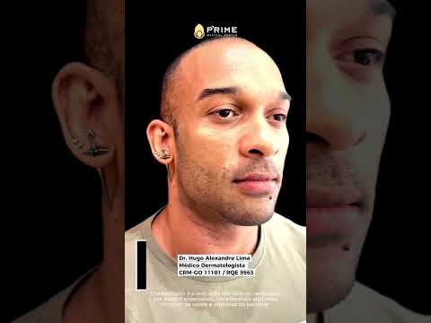 Hugo Alexandre Lima-4