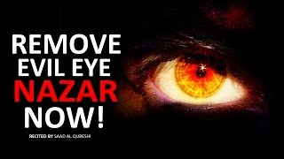 REMOVE EVIL EYE NOW!!! - Very Powerful -  MUST WATCH!!!!