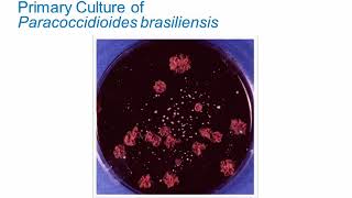 Dimorphic Fungi: Paracoccidioidomycosis and Penicilliosis [Hot Topic]