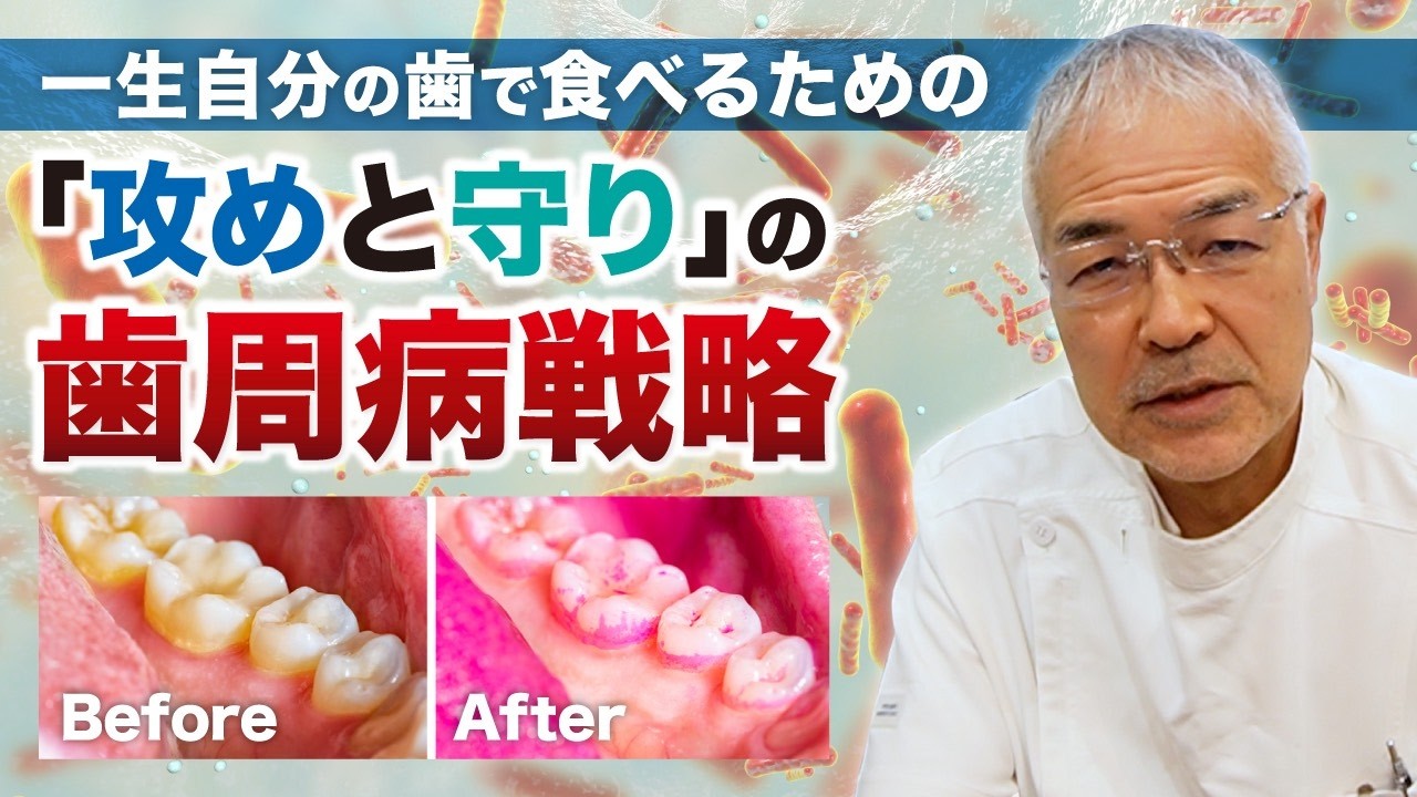 【歯科医師が解説】一生自分の歯で食べるための「攻めと守り」の歯周病戦略 #口臭 #歯周病