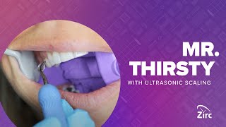 Video thumbnail for Zirc's Mr. Thirsty® One-Step | Ultrasonic Scaling Demo by Zirc Dental Products