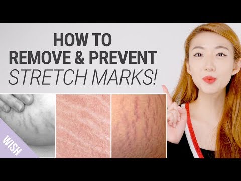 YouTube video about: Can dogs get stretch marks?