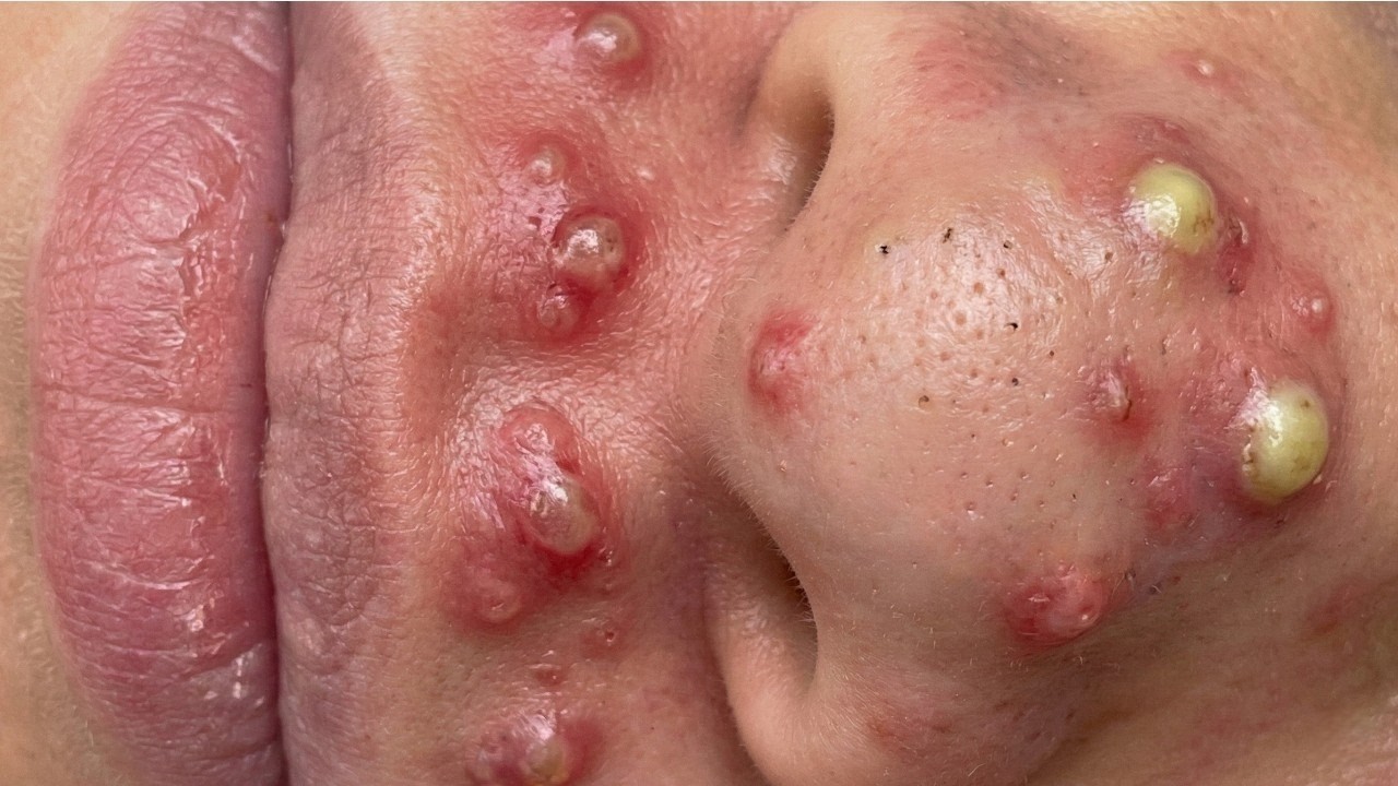 𝑺𝒐𝒐𝒕𝒉𝒊𝒏𝒈 𝑭𝒂𝒄𝒊𝒂𝒍 𝑻𝒓𝒆𝒂𝒕𝒎𝒆𝒏𝒕 𝑭𝒐𝒓 𝑺𝒕𝒓𝒆𝒔𝒔 𝑹𝒆𝒍𝒊𝒆𝒇 𝒂𝒕 𝑳𝒖𝒙𝒖𝒓𝒚 𝑺𝒑𝒂 𝑨𝒄𝒉𝒊𝒆𝒗𝒆 𝑰𝒏𝒏𝒆𝒓 𝑷𝒆𝒂𝒄𝒆 #23423