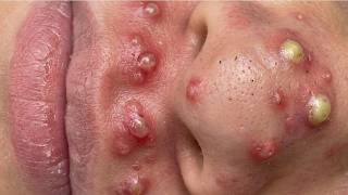 𝑺𝒐𝒐𝒕𝒉𝒊𝒏𝒈 𝑭𝒂𝒄𝒊𝒂𝒍 𝑻𝒓𝒆𝒂𝒕𝒎𝒆𝒏𝒕 𝑭𝒐𝒓 𝑺𝒕𝒓𝒆𝒔𝒔 𝑹𝒆𝒍𝒊𝒆𝒇 𝒂𝒕 𝑳𝒖𝒙𝒖𝒓𝒚 𝑺𝒑𝒂 𝑨𝒄𝒉𝒊𝒆𝒗𝒆 𝑰𝒏𝒏𝒆𝒓 𝑷𝒆𝒂𝒄𝒆 #23423