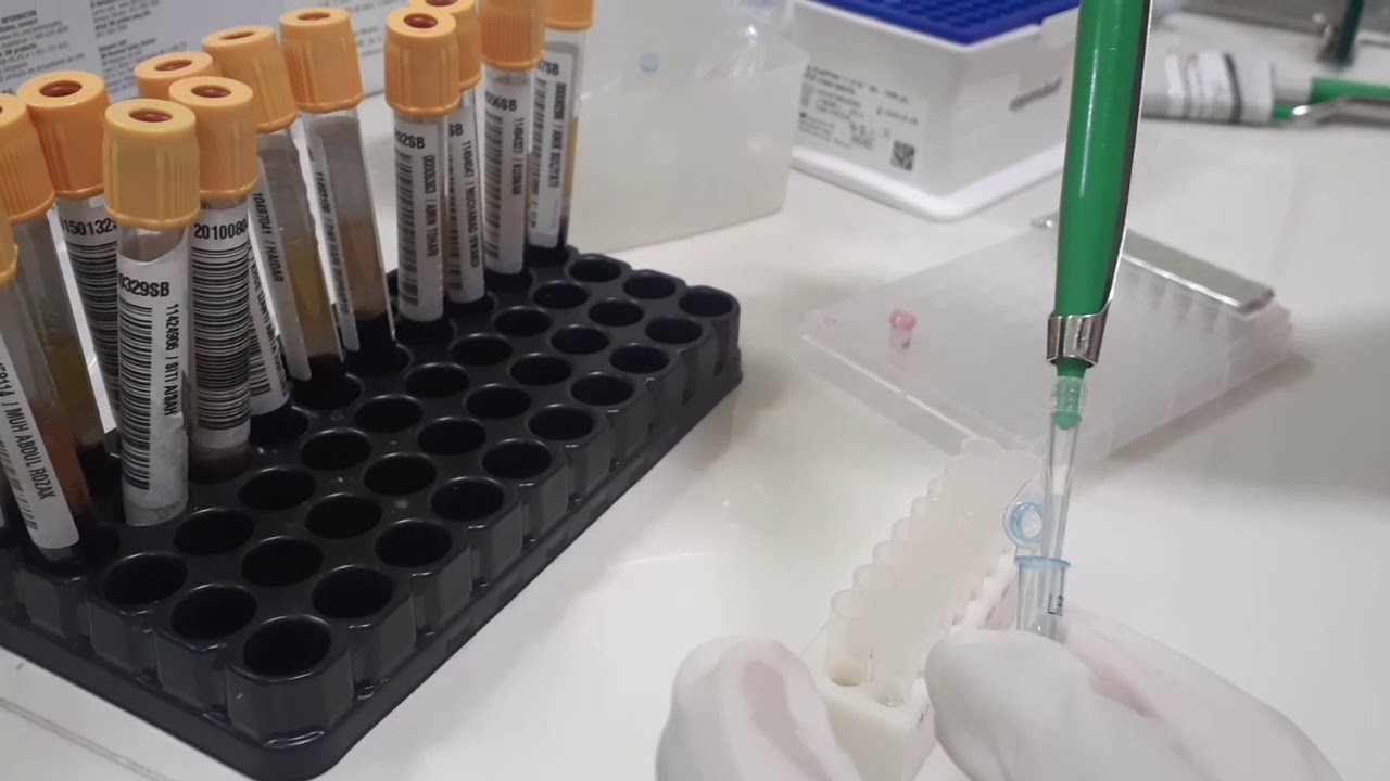 Pemeriksaan HBV DNA- Part1 Tahap Ektraksi