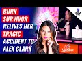 Burn Survivor Relives Her Tragic Accident To Alex Clark