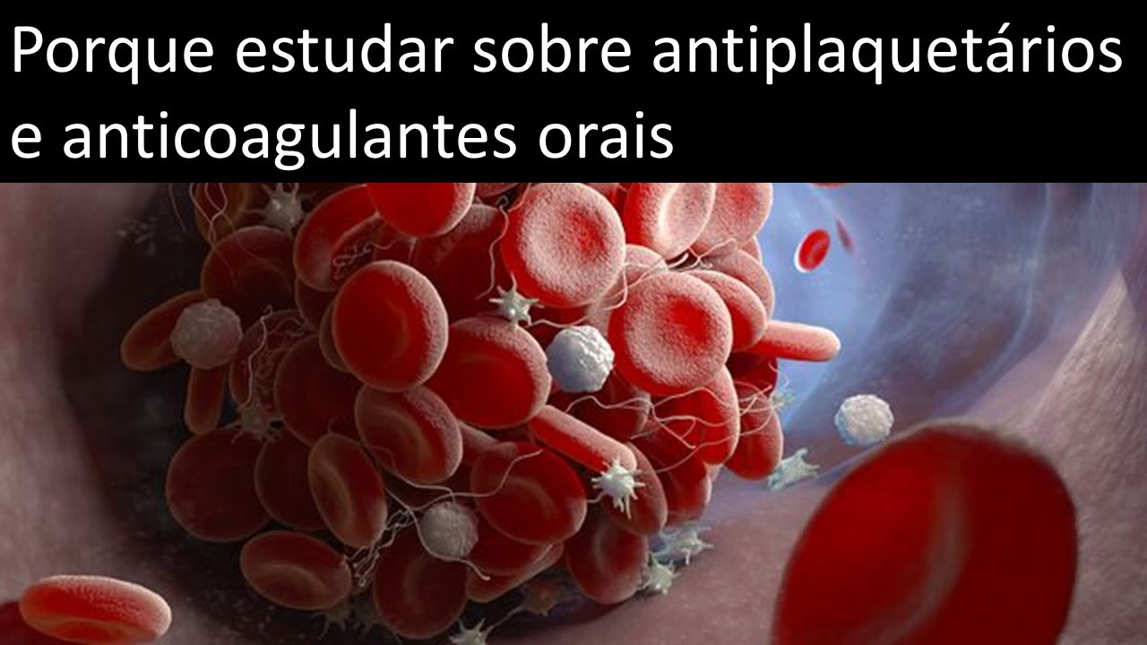 Porque estudar sobre antiplaquetários e anticoagulantes orais | Odontologia | Dra Bianca Rosa
