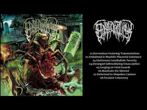 ⚫ 𝐄𝐩𝐢𝐜𝐚𝐫𝐝𝐢𝐞𝐜𝐭𝐨𝐦𝐲 - 𝐏𝐮𝐭𝐫𝐞𝐬𝐞𝐦𝐢𝐧𝐚𝐥 𝐌𝐨𝐫𝐩𝐡𝐨𝐝𝐲𝐬𝐩𝐥𝐚𝐬𝐭𝐢𝐜 𝐕𝐢𝐫𝐮𝐥𝐞𝐧𝐜𝐲 𝟐𝟎𝟏𝟒