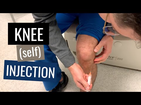 Knee Injection Steroid Technique (Blind, Anterolateral Approach)