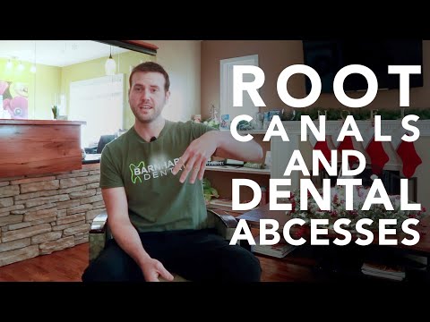 What you need to know about Root Canals and Dental Abscesses.