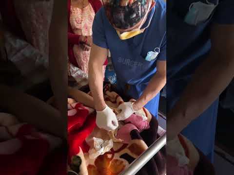 Performing Surgeries in Nepal - Part 8