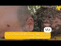 رجل تركي يغطي جسده بـ 60 كيلو غراماً من النحل لدخول "غينيس" ????????.