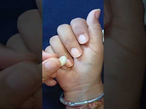 how to grow nails with garlic in 7 days/faster nails growth tips#sumanchauman#
