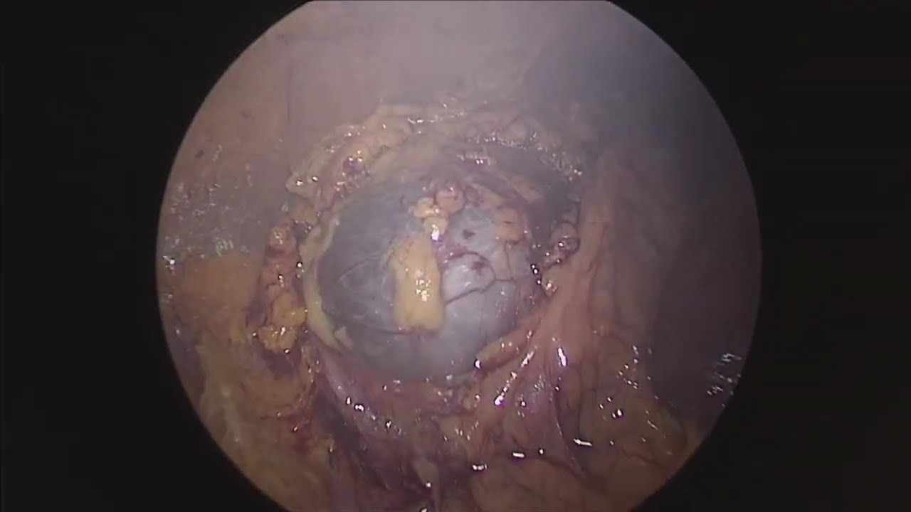 Antonio Galindo Mejia-7