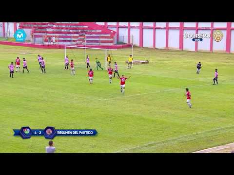 Resumen: Unión Comercio vs. Sport Boys (4-2)
