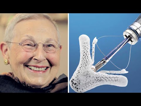 MitraClip Mitral Valve Success Story: Charlotte Cummings