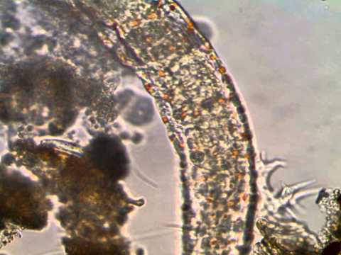 Lots of micro-organisms in pond scum (no sound)