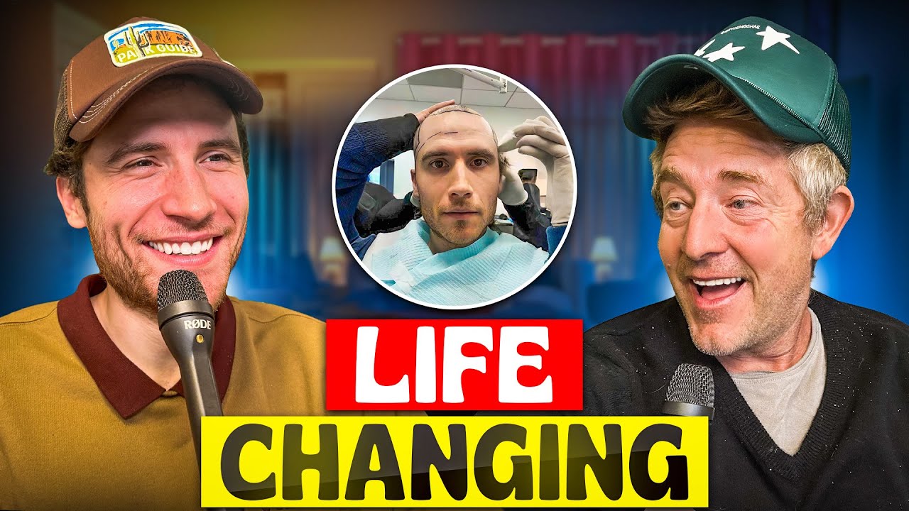 He Got a Hair Transplant - AGT Podcast