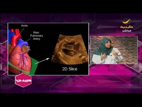 img-video