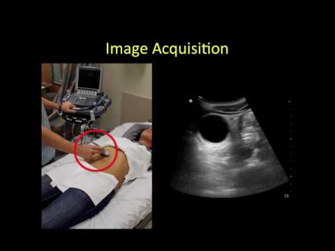 Gallbladder point of care ultrasound tutorial