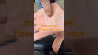 Download lagu How to get fiberglass out of your hand! #howto #lifehacks #tape #fiberglass mp3 Download lagu How to get fiberglass out of your hand! #howto #lifehacks #tape #fiberglass mp3