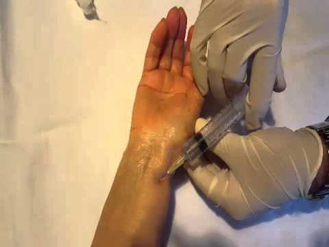 Mal di basso addome e parte bassa della schiena e tira nelle gambe Se sia possibile per pungere diclofenac in osteocondrosi
