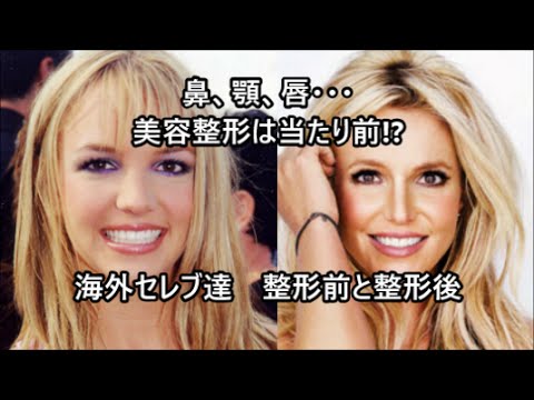 セレーナ・ゴメス、整形疑惑に反論も美容整形は認めた