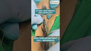 Download lagu Low Cost Labiaplasty, Vagina Tighten Surgery, Hymenoplasty Treatment in Vesu, Athwagate, Surat mp3