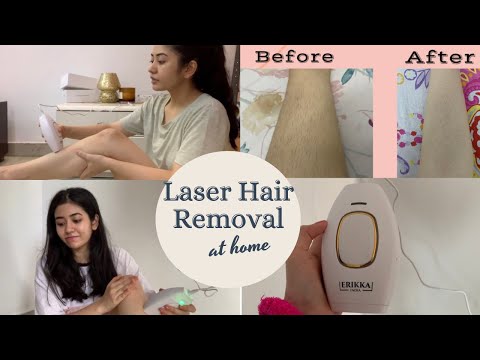 Trying Laser Hair Removal at Home | Permanent Hair...