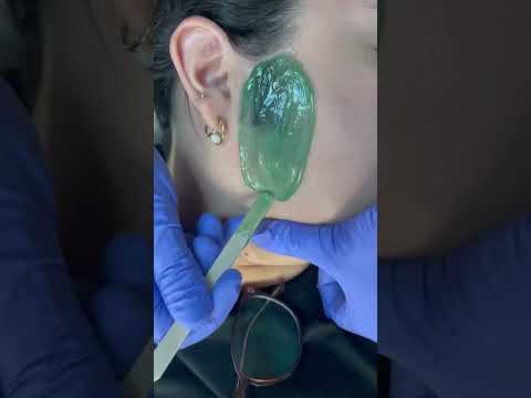 Professional sideburn wax performed by me. Using Nacach hard green wax. #esthetician #waxing