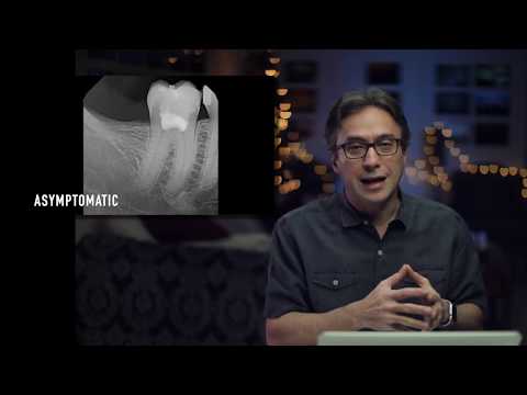 Vital Pulp Therapy: Adult Pulpotomy with Dr. Nasseh